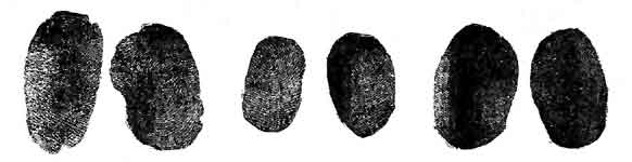 Promiscour thumb-prints easily distinguishable in original impression.