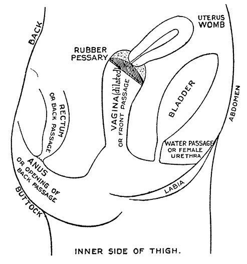 [INNER SIDE OF THIGH]