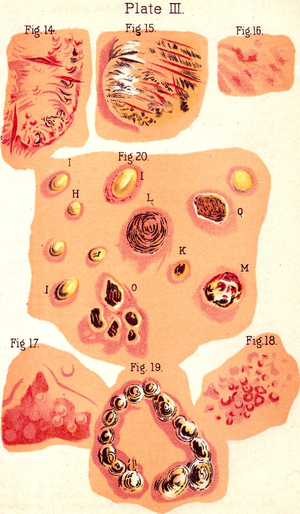 Illustration: Plate III. Fig. 14. Fig. 15. Fig. 16. Fig. 20. Fig. 17. Fig. 19. Fig. 18.