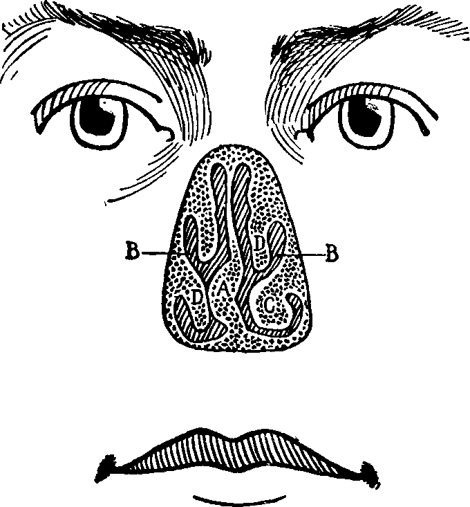 Illustration: Fig. 15. Anterior view of deformed nasal passages as seem with the projecting portion of the nose removed.