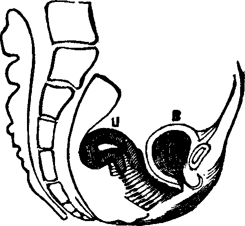 Illustration: Fig. 10. Flexion, u, Uterus, B, Bladder.