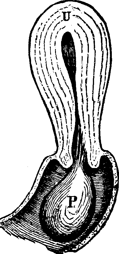 Illustration: Fig. 21. U, Uterus. P, Polypus.