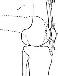 PATELLA AND MUSCLE