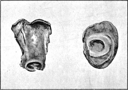 Fig. 46.