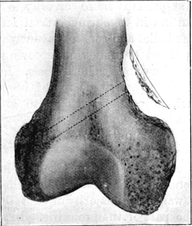 Fig. 52.