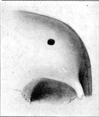 Fig. 62