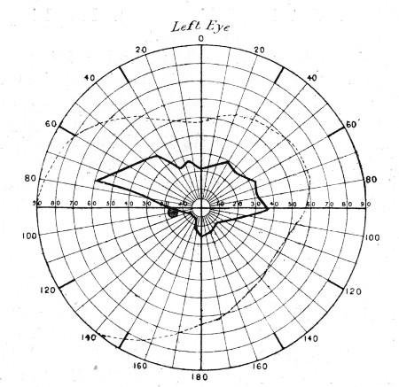 Fig. 76.