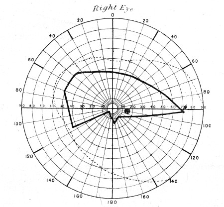 Fig. 77.