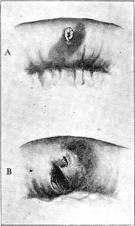 Fig. 87.