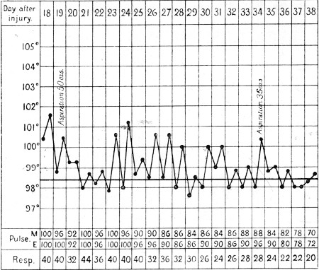 Temperature Chart 5.