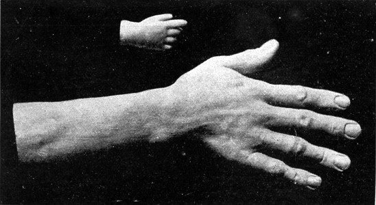 THE HANDS OF "TOM THUMB" AND LOUSHKIN, THE RUSSIAN GIANT.