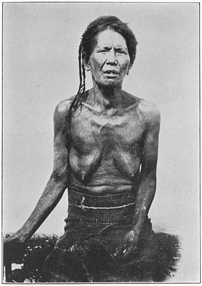 Blind woman of Bontoc pueblo