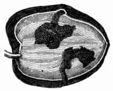 Fig. 68.—Gallery formed by larva of Dacus oleæ.