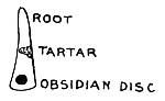 Fig. 58. Obsidian disk inserted     in tooth of skeleton found in Mound No. 17.