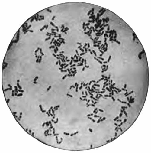 Bacillus diphtheriæ