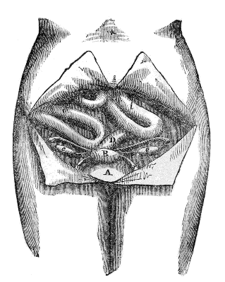 Front View of the Female Pelvis