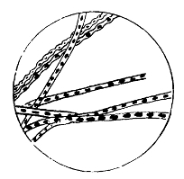 Threads of Bacillus Anthracis, Showing Spores