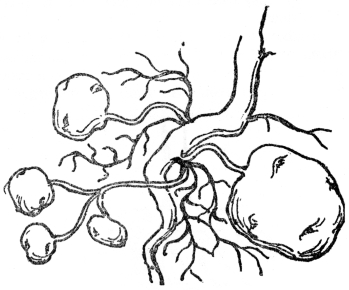 FIG. 8.—TUBERS OF THE COMMON POTATO  Potatoes are swollen portions of rootstock.