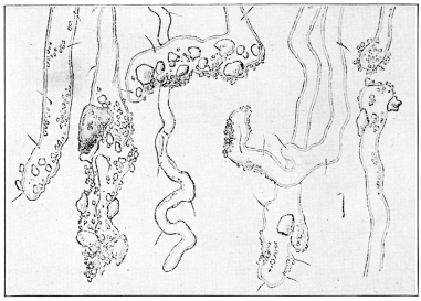 Root Hairs with Fine Soil Particles Attached. Note soil, water, and air spaces. Much magnified. (After U. S. Department of Agriculture. Courtesy of Brooklyn Botanic Garden.)