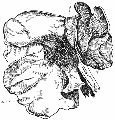 Fig. 82. Hirnéola Aurícula Júdae (Judasoor).