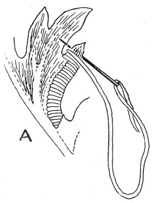 Diagram A