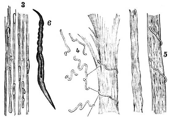 Four types of muscular fibers of the intenstine.