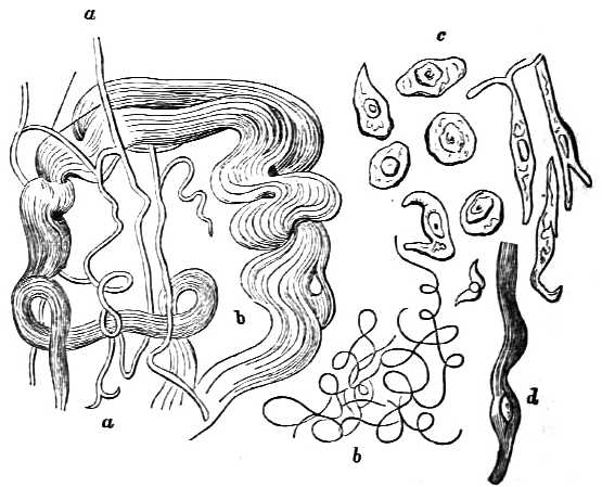 Diagrams of fibers in artery wall.