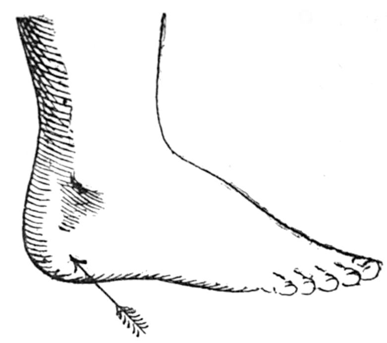 Foot with arrow pointing to the heel