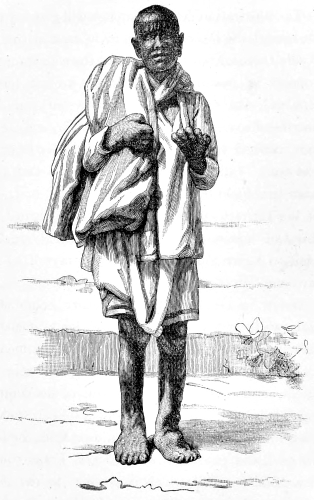 A Leper Beggar