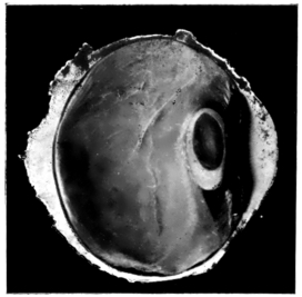 cross-section of eye