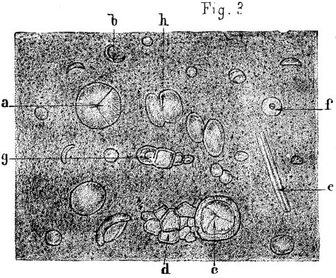 FIG. 3.—Commentry cannel coal, X200.