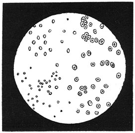 Fig. 29. Laagste afgietseldiertjes.