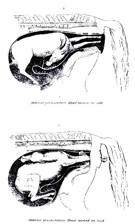 PLATE XVIII.