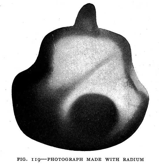 FIG. 119–PHOTOGRAPH MADE WITH RADIUM