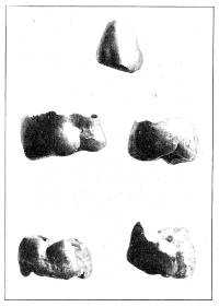 Tooth crowns found in an Etruscan
tomb